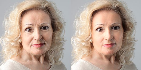 Wie Sie mit Hautveränderungen während der Menopause umgehen