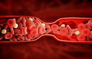 Testosteronersatztherapie: ein Risikofaktor für Blutgerinnsel 