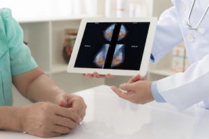 Menopause-Status besserer Indikator für Mammographien als Alter