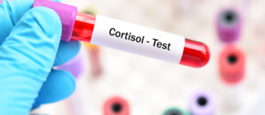 How to Manage Cortisol Levels Naturally