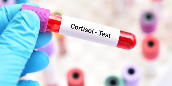 How to Manage Cortisol Levels Naturally