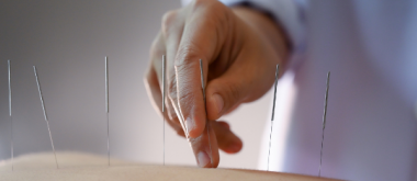 Linderung von Parkinson-Symptomen mithilfe von Akupunktur