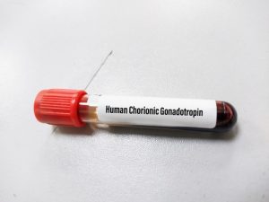 Kann hCG-Hormon den Testosteronspiegel erhöhen? 1