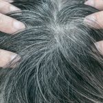 Lassen sich graue Haare rückgängig machen?