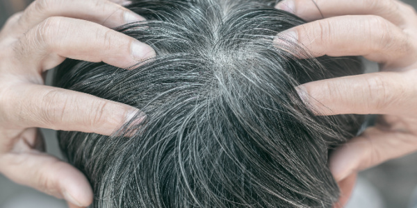 Lassen sich graue Haare rückgängig machen?