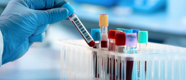 Der gängige Bluttest, der vorhersagt, wie schnell Alzheimer auftritt