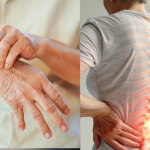 Zwei Schlüsselgene identifiziert, die rheumatoide Arthritis und Osteoporose verbinden