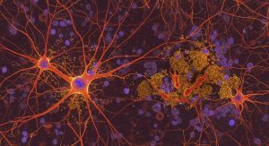 Die versteckten Abwehrkräfte Ihres Gehirns gegen Alzheimer 1