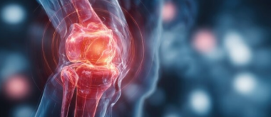 Die besten Bewegungsarten gegen schmerzhafte Kniearthrose