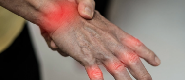 Eine traditionelle brasilianische Pflanze zeigt unerwartete Wirksamkeit gegen Arthritis 2