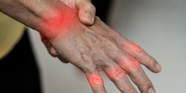 Eine traditionelle brasilianische Pflanze zeigt unerwartete Wirksamkeit gegen Arthritis 2