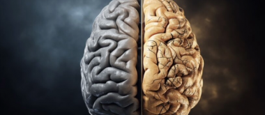 Die Menopause steht mit dem Verlust von grauer Substanz in wichtigen Hirnregionen in Verbindung