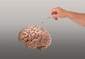 Ein einfacher Bluttest kann Alzheimer Jahre vor Gedächtnisverlust vorhersagen 2