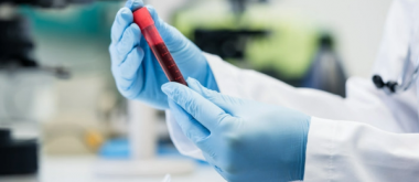 Ein einfacher Bluttest kann Alzheimer Jahre vor Gedächtnisverlust vorhersagen