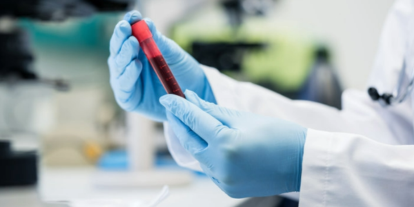 Ein einfacher Bluttest kann Alzheimer Jahre vor Gedächtnisverlust vorhersagen