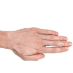 Ein einfaches Foto der Hand könnte der Schlüssel zur Erkennung einer schweren Krankheit sein 1