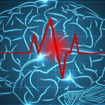 Ein Schlaganfall löst eine verborgene Veränderung im Gehirn aus, die einer Verjüngung ähnelt