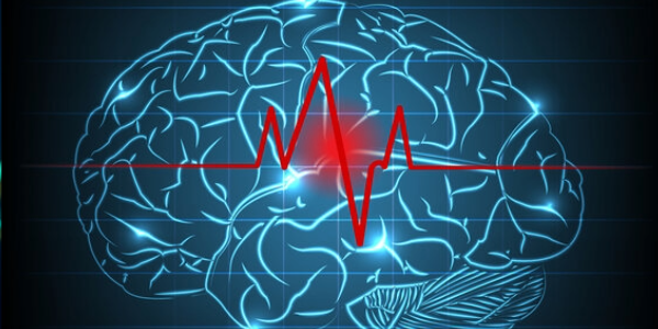 Ein Schlaganfall löst eine verborgene Veränderung im Gehirn aus, die einer Verjüngung ähnelt