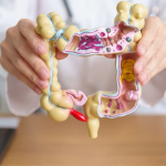 Schluss mit der Darmspiegelung? Neuer Stuhltest erkennt 90 % aller Darmkrebsfälle