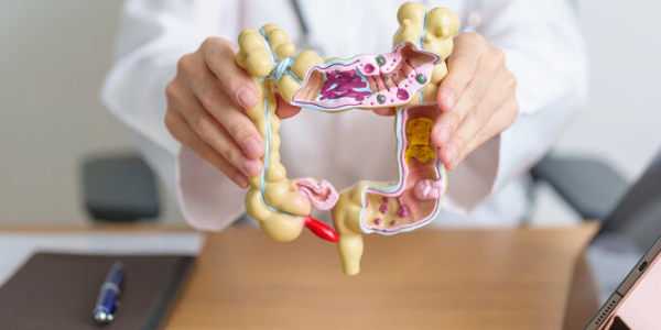 Schluss mit der Darmspiegelung? Neuer Stuhltest erkennt 90 % aller Darmkrebsfälle