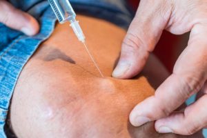 Neue Hoffnung für Knochen und Gelenke: Forscher entwickeln regenerative Therapien 2