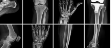 Neue Hoffnung für Knochen und Gelenke: Forscher entwickeln regenerative Therapien