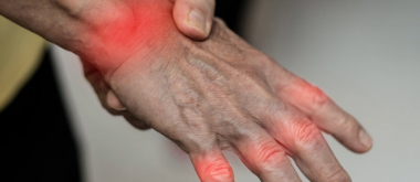 Verschmutzte Luft könnte rheumatoide Arthritis verschlimmern
