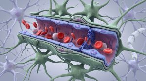 Alzheimer vorbeugen: Wie Gene und Bewegung die Widerstandskraft des Gehirns beeinflussen 3