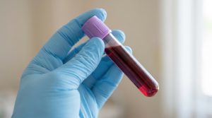 Bluthochdruck in den Wechseljahren: Warum eine unerkannte Hormonstörung dahinterstecken könnte 1