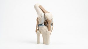 Ein Schalter für stärkere Knochen? Forscher entdecken einen neuen Ansatz gegen Osteoporose 2